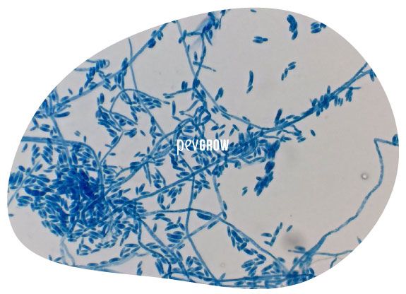 Microscopic image showing the fungal attack on the secondary roots*